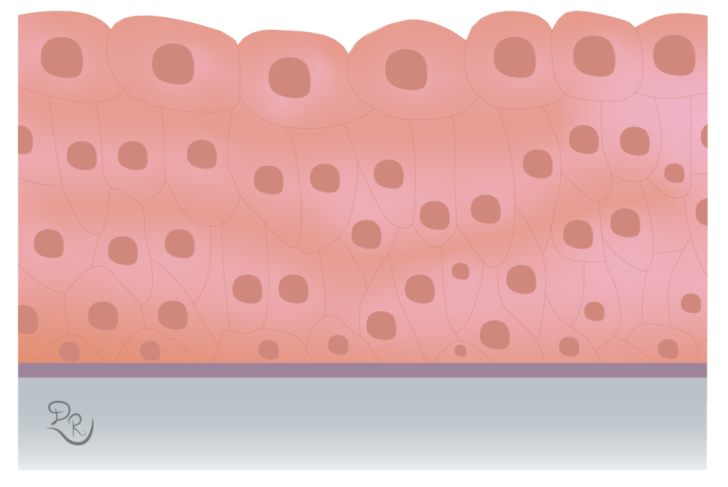 Ćelije epitela prelaznog tipa, poređane u tri sloja.
